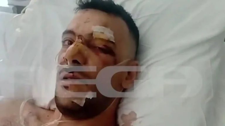 Άγρια επίθεση σε 35χρονο σε πανηγύρι στη Μυτιλήνη: Τον μαχαίρωσε 18 φορές (video)