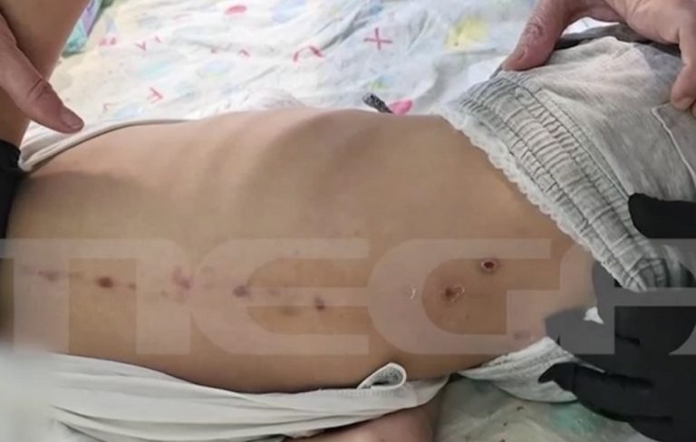 «Θρίλερ» με 7χρονο ΑμεΑ που πήγε στο νοσοκομείο με σημάδια κακοποίησης (video)