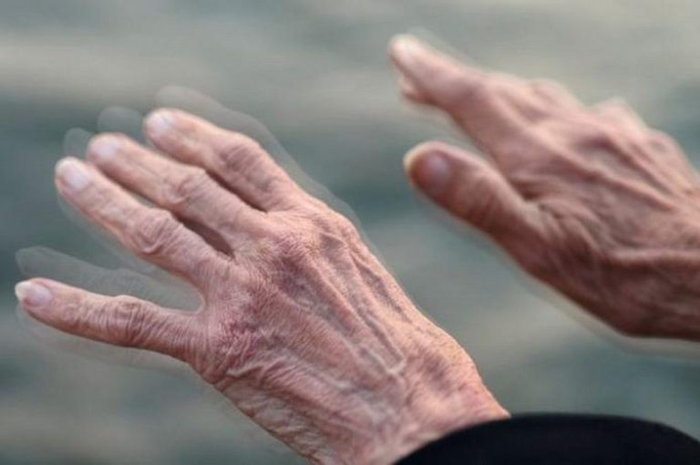 Το πιο αποτελεσματικό και οικονομικό «φάρμακο» για τη νόσο Πάρκινσον