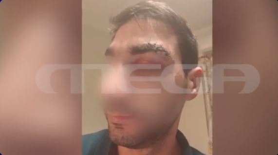 Σε σοκ ο γιατρός που γρονθοκοπήθηκε από ασθενή