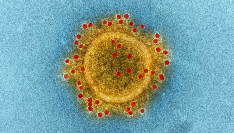Ιός Nipah: Η επόμενη μεγάλη απειλή; Το ποσοστό θνησιμότητας φτάνει το 75%