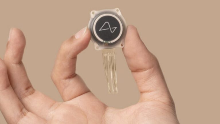 Το Neuralink και τα εμφυτεύματα εγκεφάλου: Το επόμενο βήμα στην τεχνολογία (photo+video)